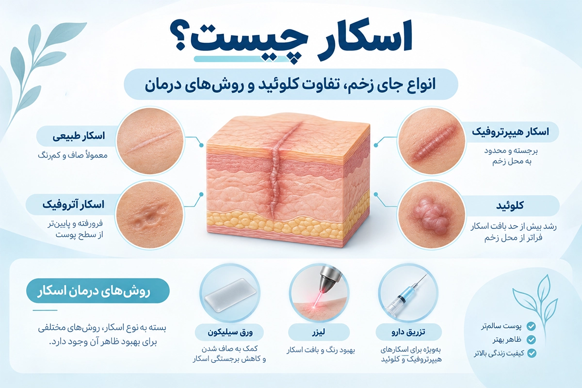 اسکار چیست؟ انواع جای زخم، تفاوت کلوئید و روش‌های درمان