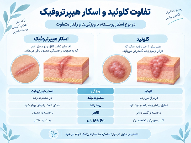 اینفوگرافیک تفاوت کلوئید و اسکار هیپرتروفیک از نظر محدوده رشد، ظاهر، روند بهبود و احتمال عود