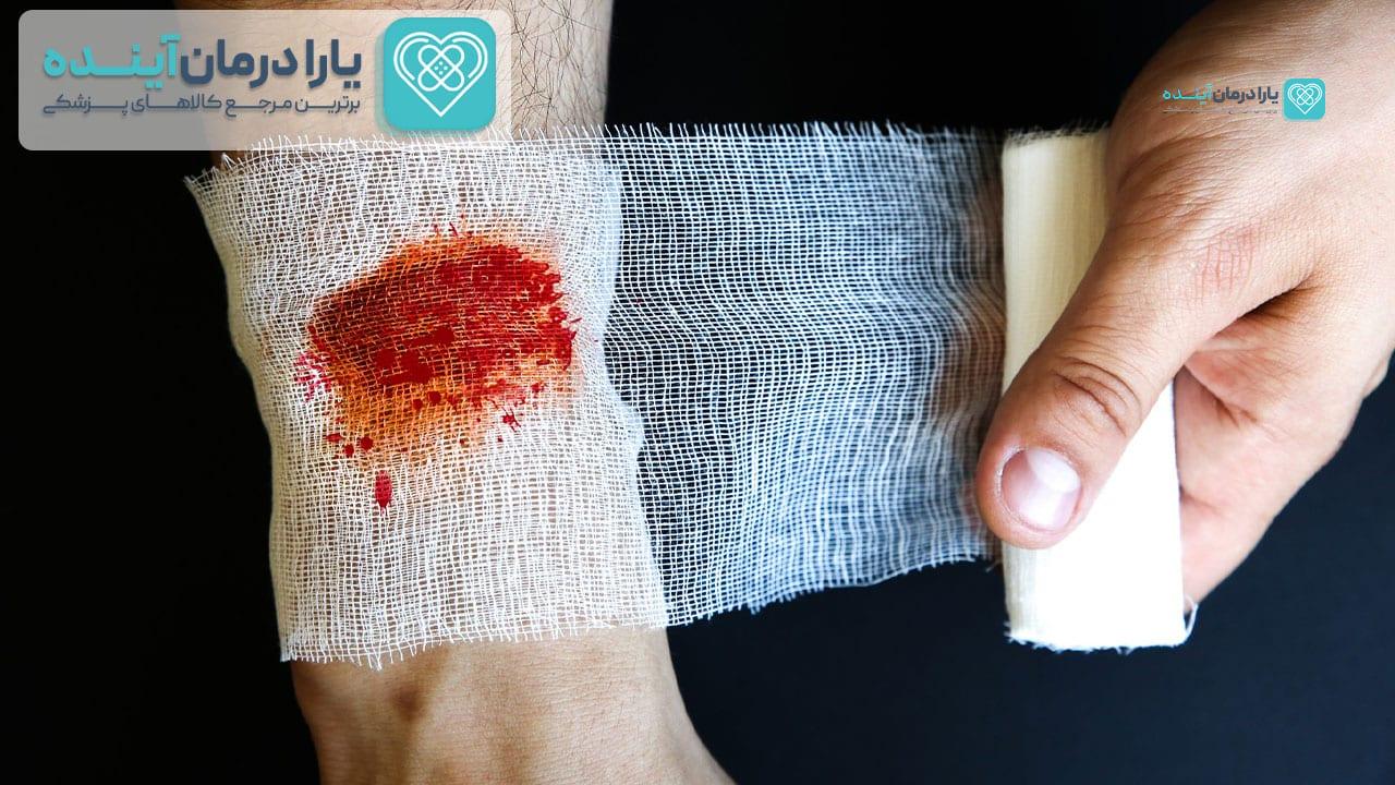 معرفی و شناخت انواع عفونت زخم و تشخیص آن