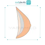 پروتز سینه اکسترنال مثلثی آموئنا