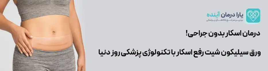 ورق سیلیکون شیت نواری رفع اسکار 