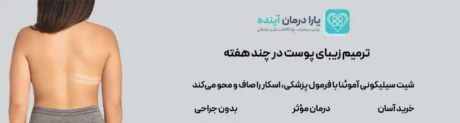 ورق سیلیکون شیت رفع اسکار