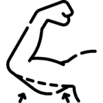 براکیوپلاستی (لیفت بازو)