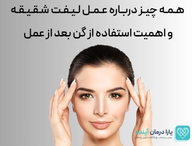 عمل لیفت شقیقه: راهنمای کامل، مزایا، مراقبت‌ها و نکات بعد از عمل