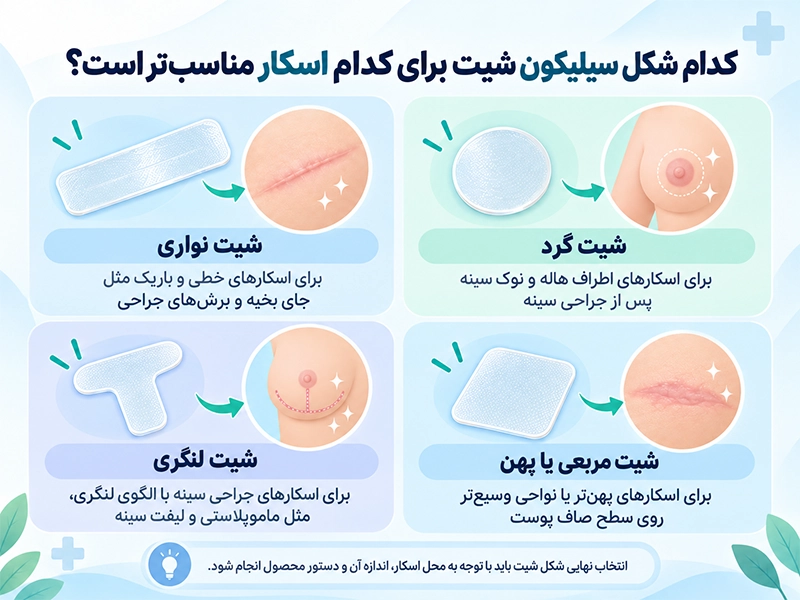 راهنمای انتخاب شکل سیلیکون شیت شامل شیت نواری برای اسکارهای خطی، شیت گرد برای اسکار اطراف هاله و نوک سینه، شیت لنگری برای اسکار جراحی سینه و شیت مربعی برای نواحی وسیع‌تر
